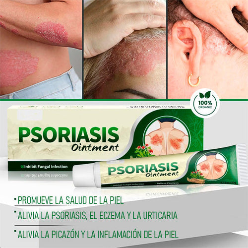 Crema Antifúngica y Antipicazón – Tratamiento Natural para Tiña, Hongos y Psoriasis