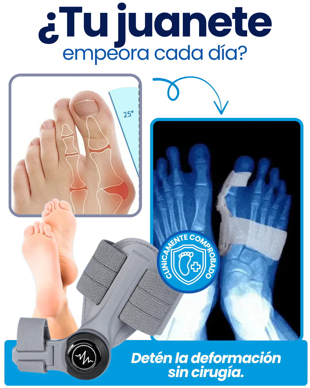 OrtoFix Pro™ Corrector de juanetes + Envío Gratis + Regalo 🎁